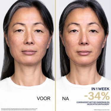 LiftDefine Radiance Night Concentrate, 